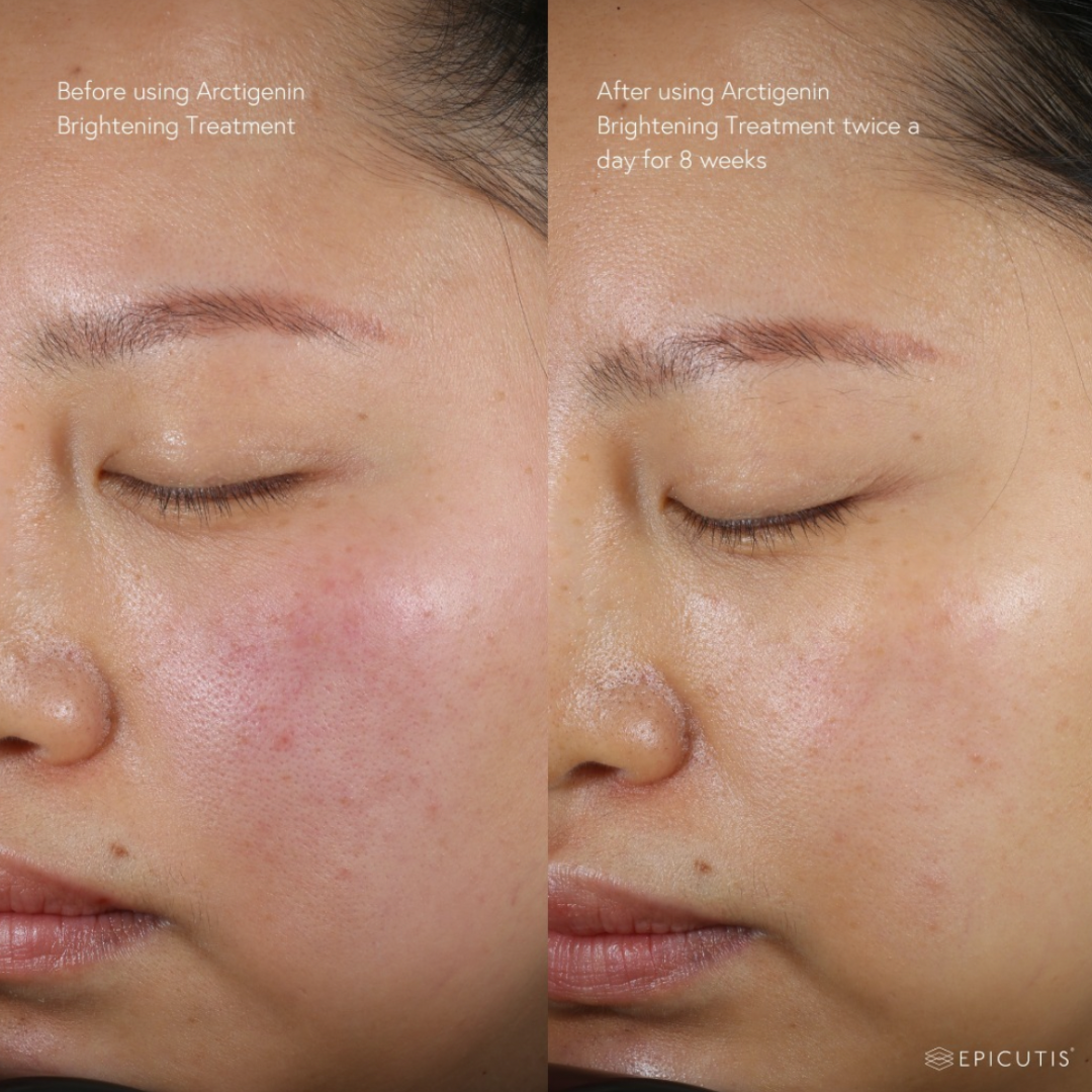 Epicutis Arctigenin Brightening Treatment