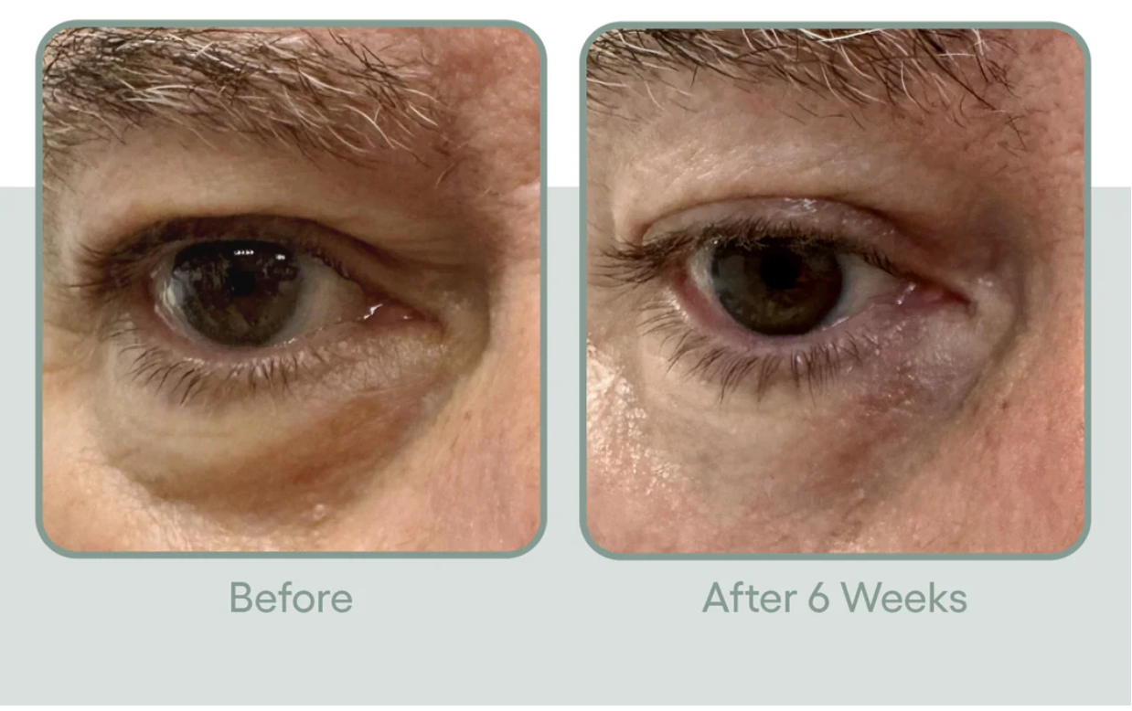 (plated)™ Skin Science I Eye Serum