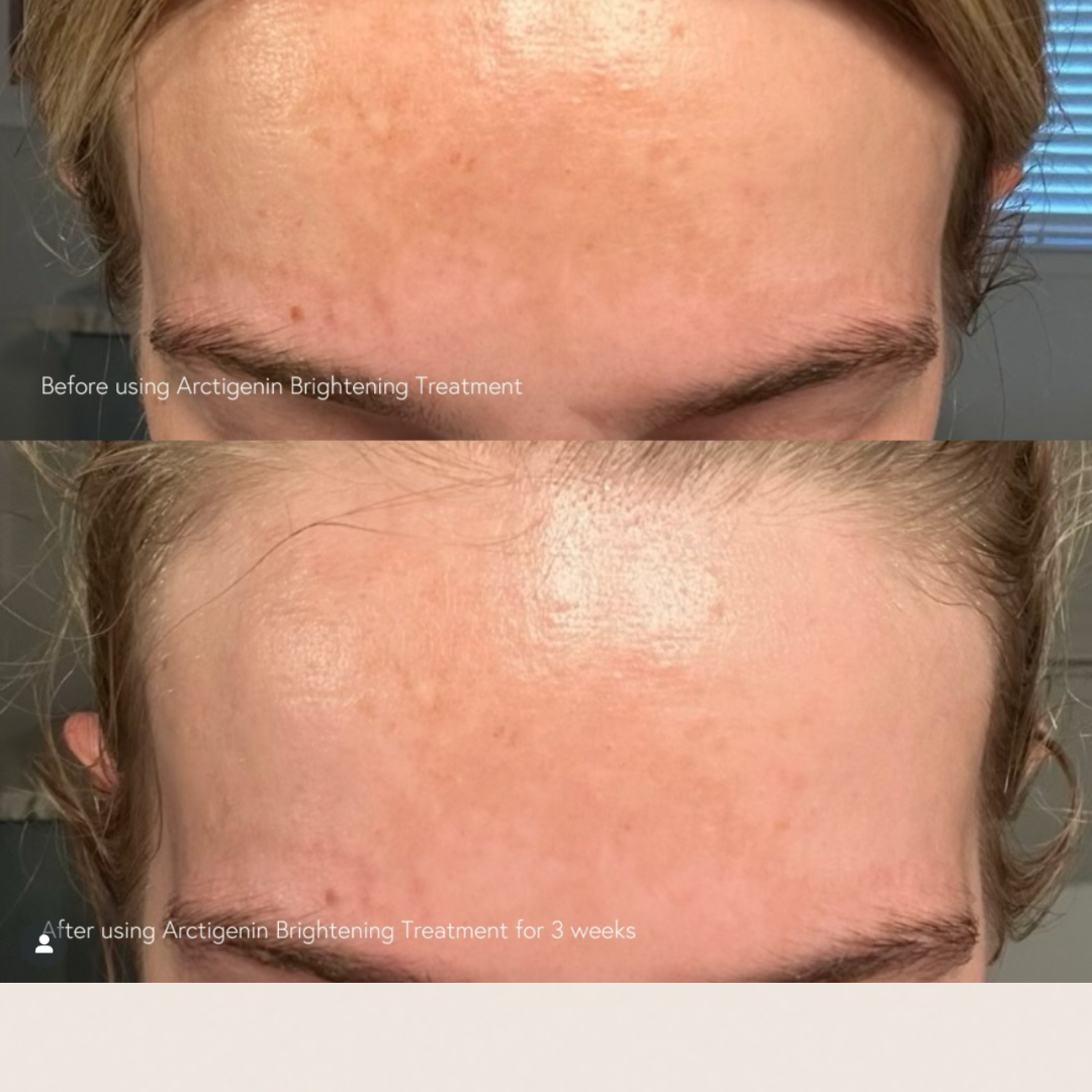 Epicutis Arctigenin Brightening Treatment