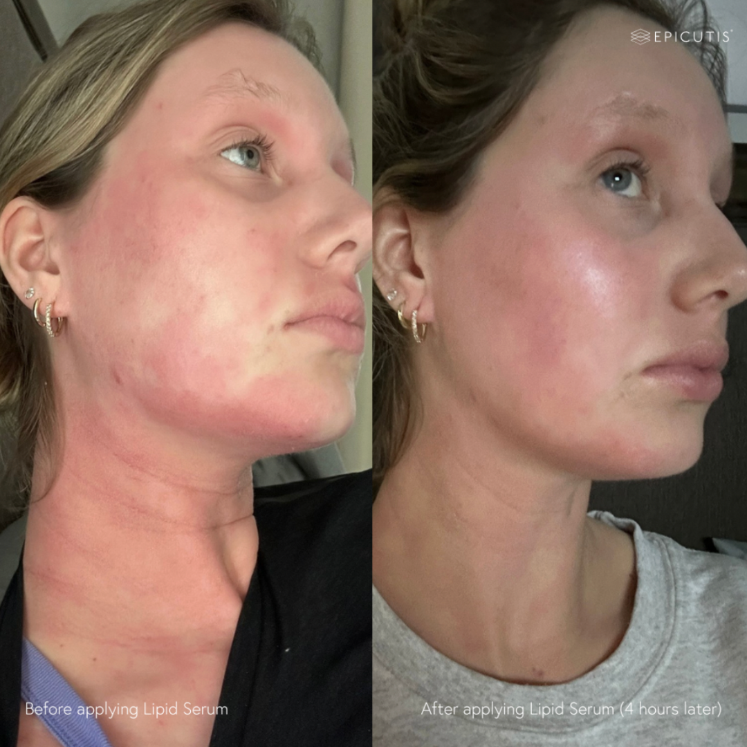 Epicutis Lipid Serum
