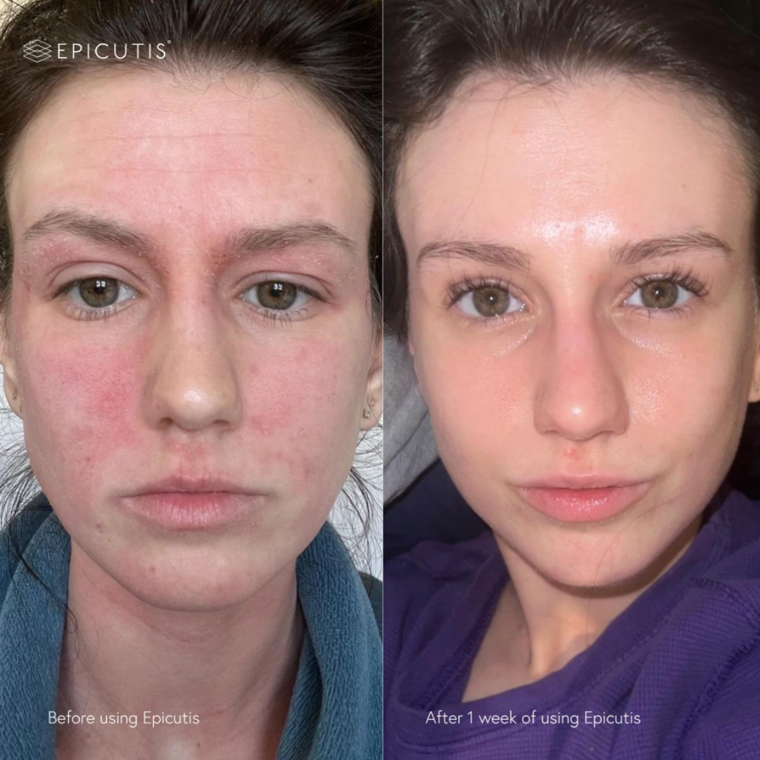 Epicutis Lipid Serum