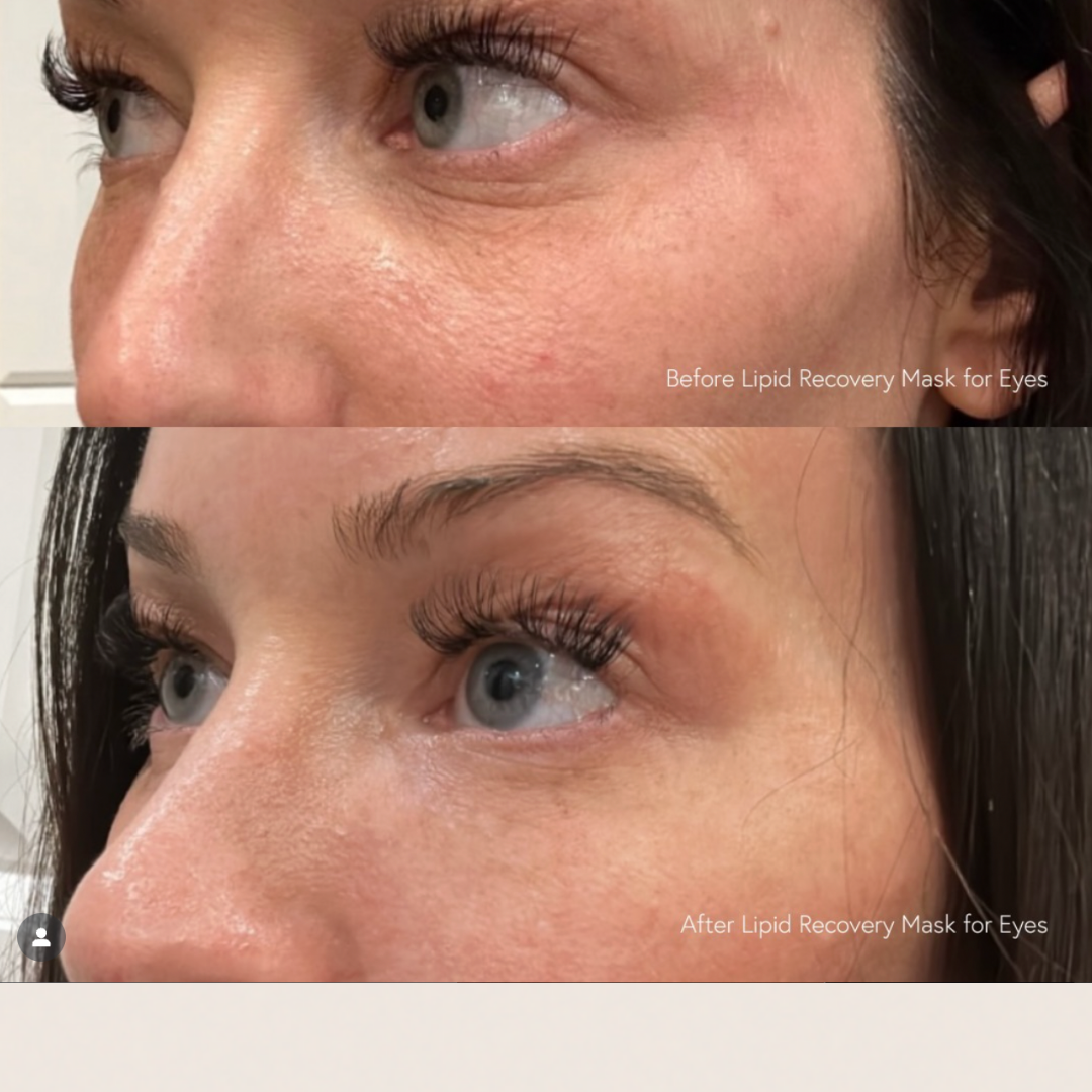 Epicutis Lipid Recovery Mask for Eyes