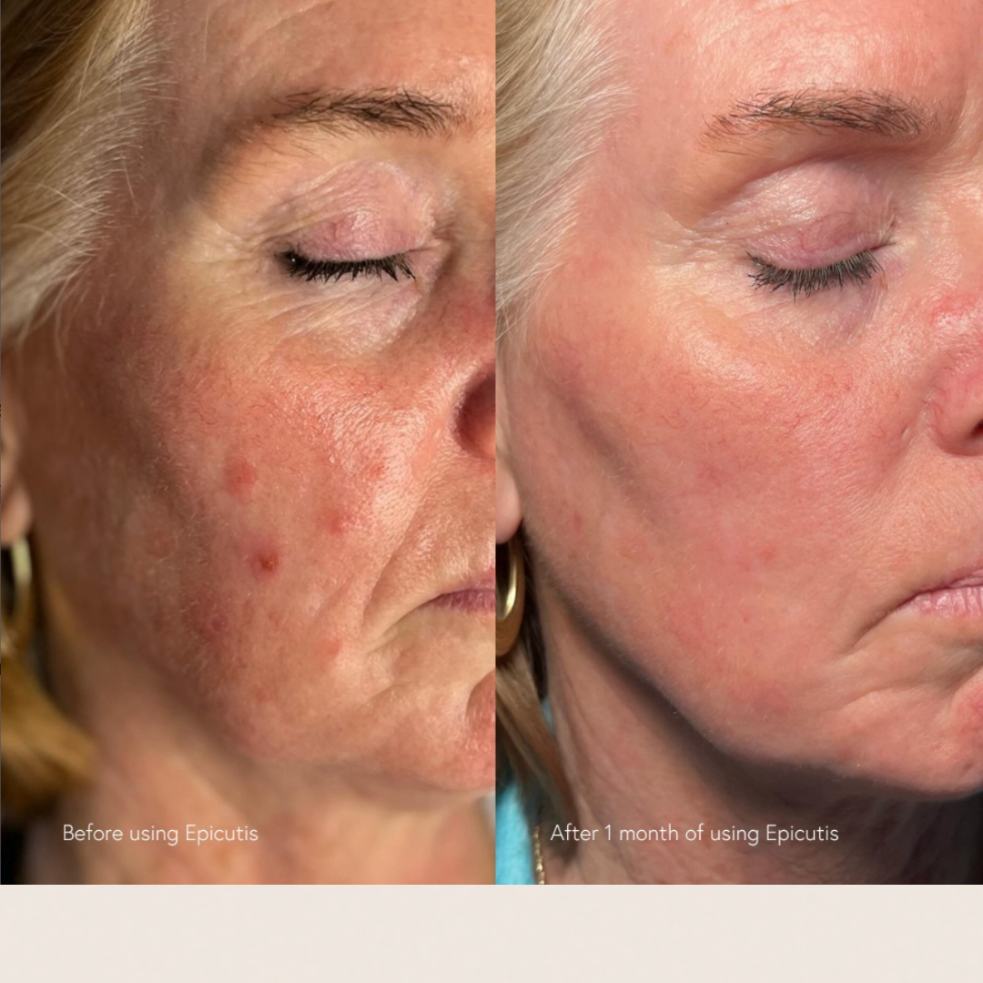 Epicutis Lipid Serum