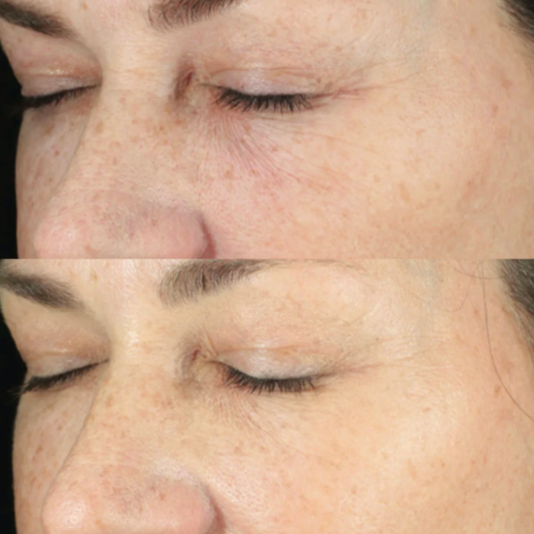 Hydrinity Retaxome Daily Retinal Hydrator