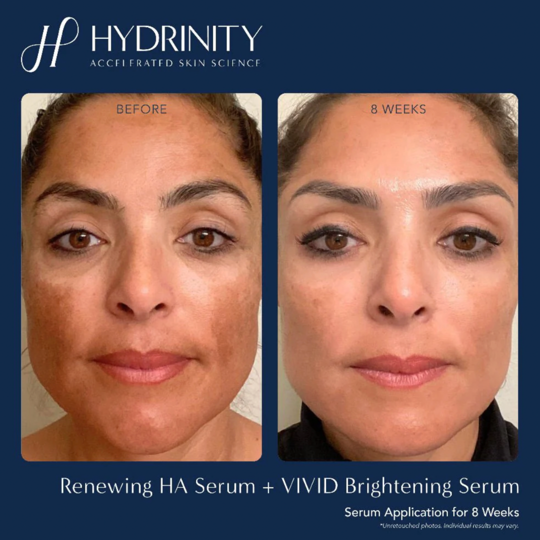 Hydrinity Vivid Brightening Serum