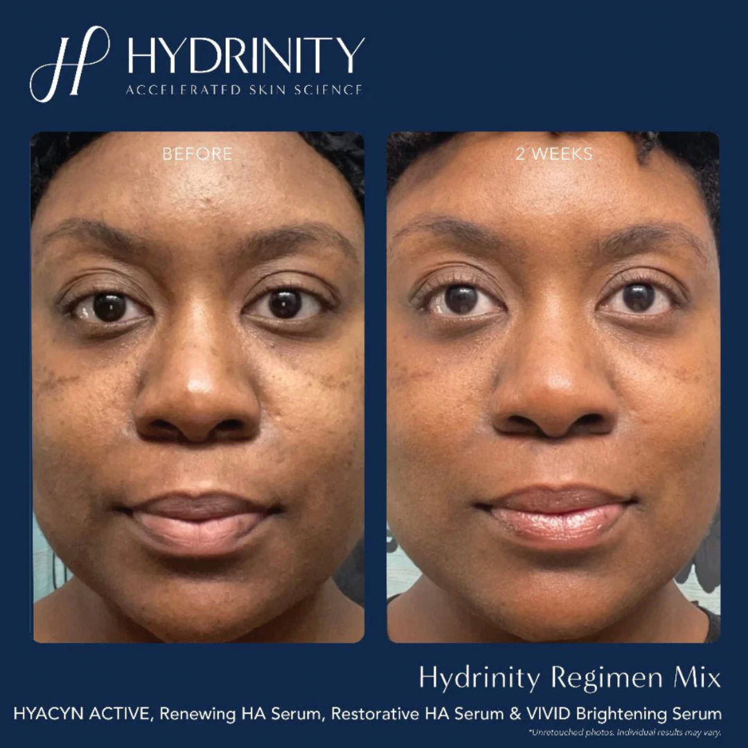 Hydrinity Vivid Brightening Serum