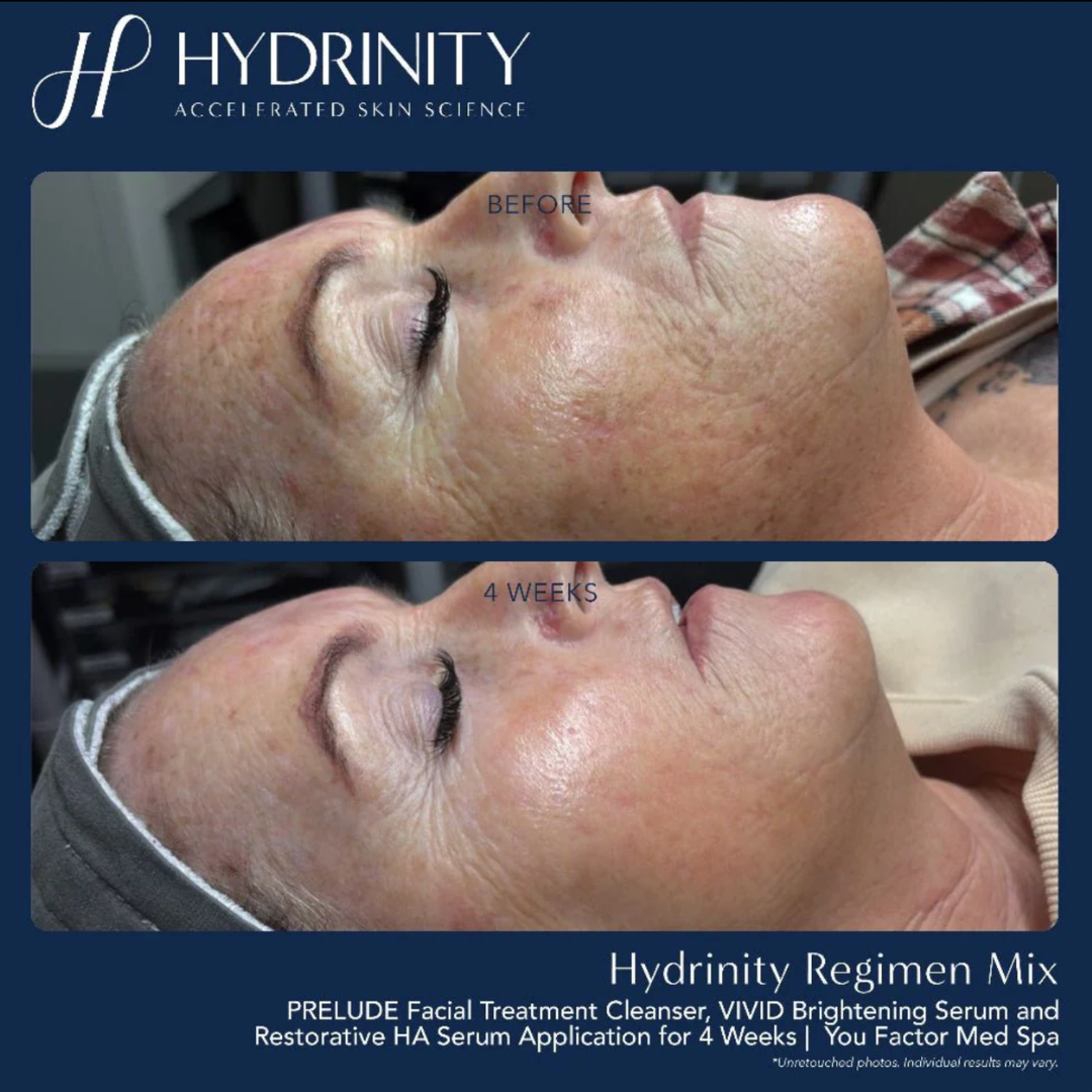 Hydrinity Vivid Brightening Serum