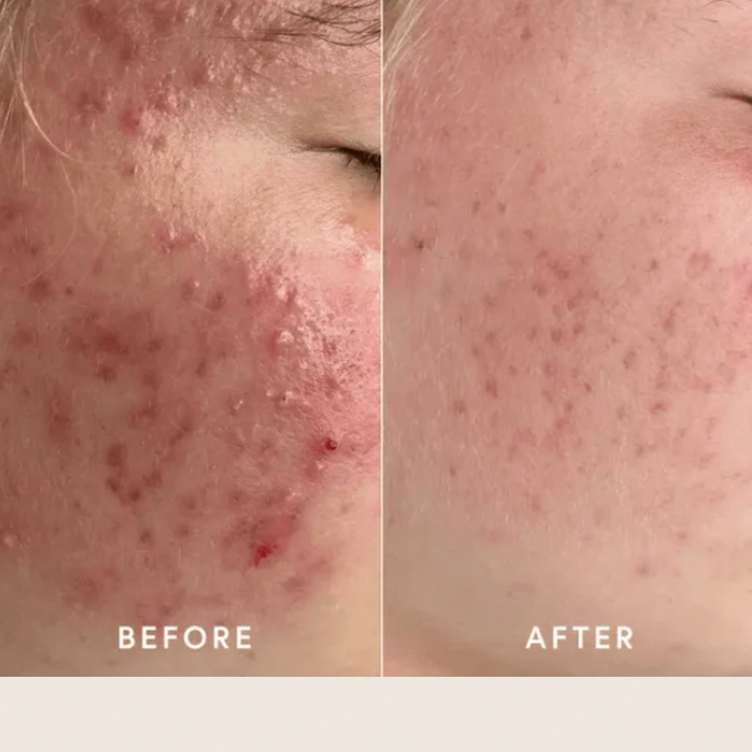 Epicutis Lipid Serum