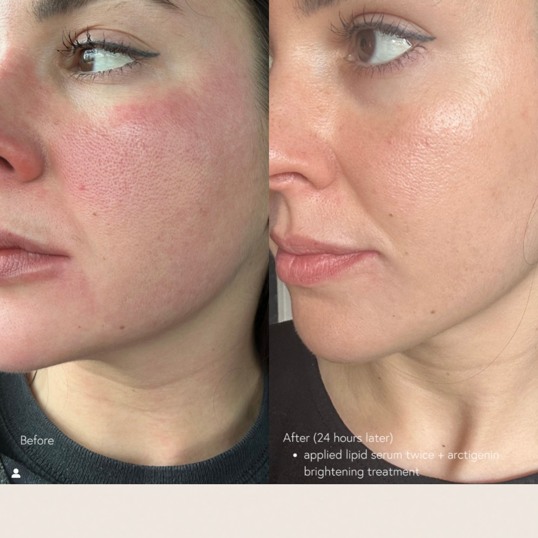 Epicutis Lipid Serum