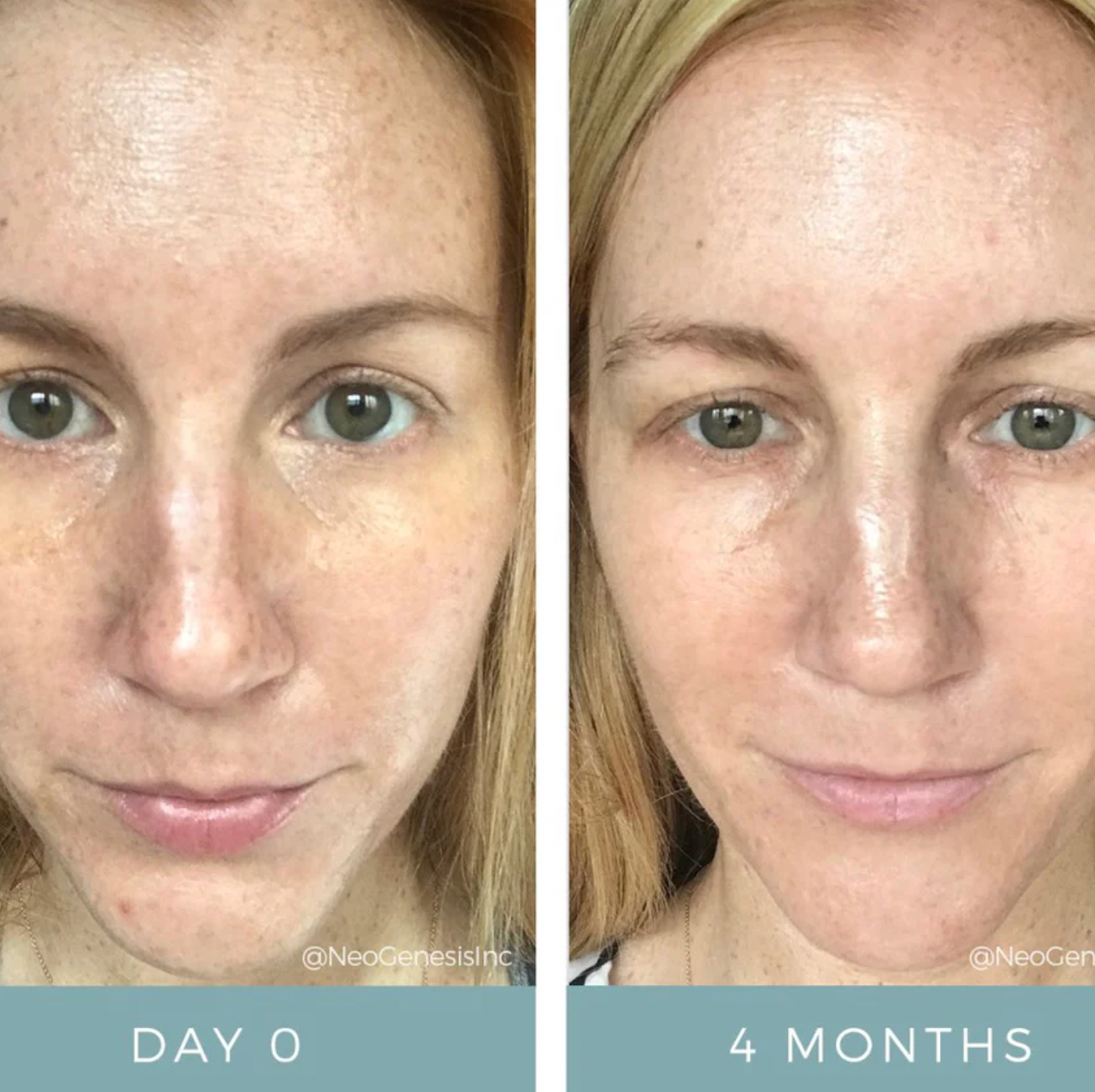 NeoGenesis Recovery Serum